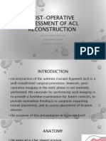 Post-Operative Assessment of Acl Reconstruction: DR - Sayf Aldeen Hussam Orthopedic Trainee Baghdad Medical City