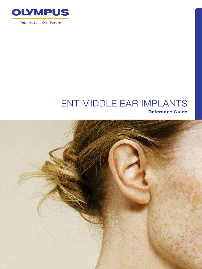 Middle Ear Implants Reference Guide Prosthesis Implant (Medicine)