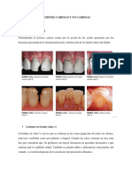 Lesiones Cariosas y No Cariosas