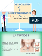 Hipotiroidismo e Hipertiroidismo