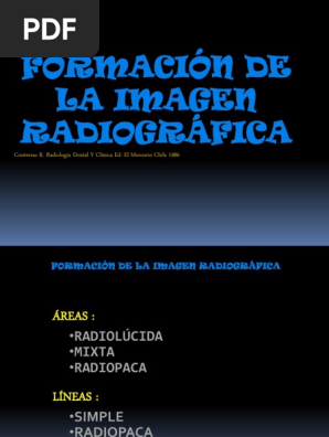 radiolucida Instagram posts - Gramho.com