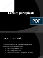 Leziuni - Periapicale Radiologie