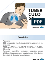 Tuberculose