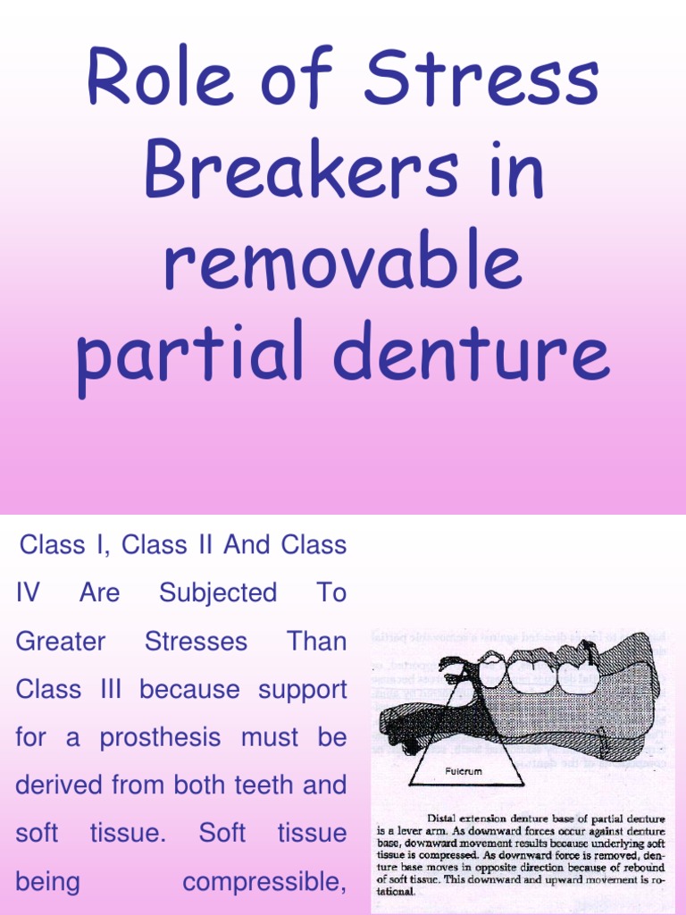 Role of Stress Breakers in Removable Partial Denture PDF Dentures