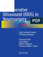 Intraoperative Ultrasound (IOUS) in Neurosurgery