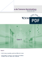 Casos Complexos de Tumores Germinativos - Caso 3 - Não Seminoma, Linfadenectomia Retroperitoneo Com Marcadores Elevados Pos HDCT TMO