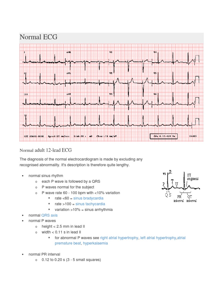 Normal Ecg Electrocardiography Cardiology