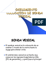 Procedimiento de colocación de sonda vesical