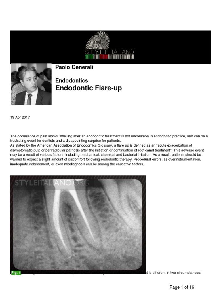 Paolo Generali Endodontic Flare Up PDF Dentistry Medical Specialties