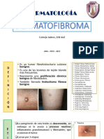 Derma To Fibroma