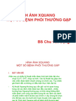 HA Xquang Mot So Benh Phoi Thuong Gap