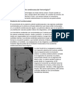 Monografia ACV HEMORRAGICO 