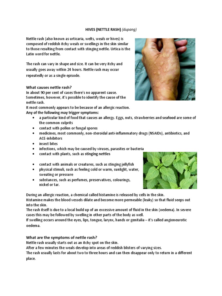 What Causes Nettle Rash? | PDF | Allergy | Immunology