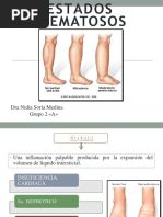 Exposicion Estado Edematoso