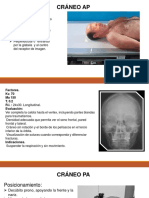 Craneo Posicionamiento