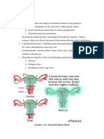 Penatalaksanaan CA Endometrium