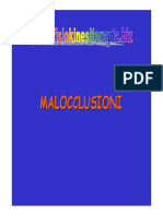 Maloclusion