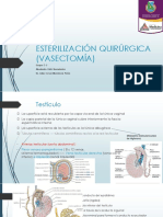 Vasectomia ppt