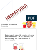 Hematuria en Pediatria