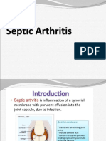 Septic Arthritis