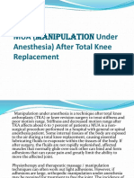 MUA (Manipulation Under Anesthesia) After Total Knee Replacement