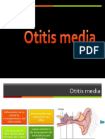 Otitis Media Aguda