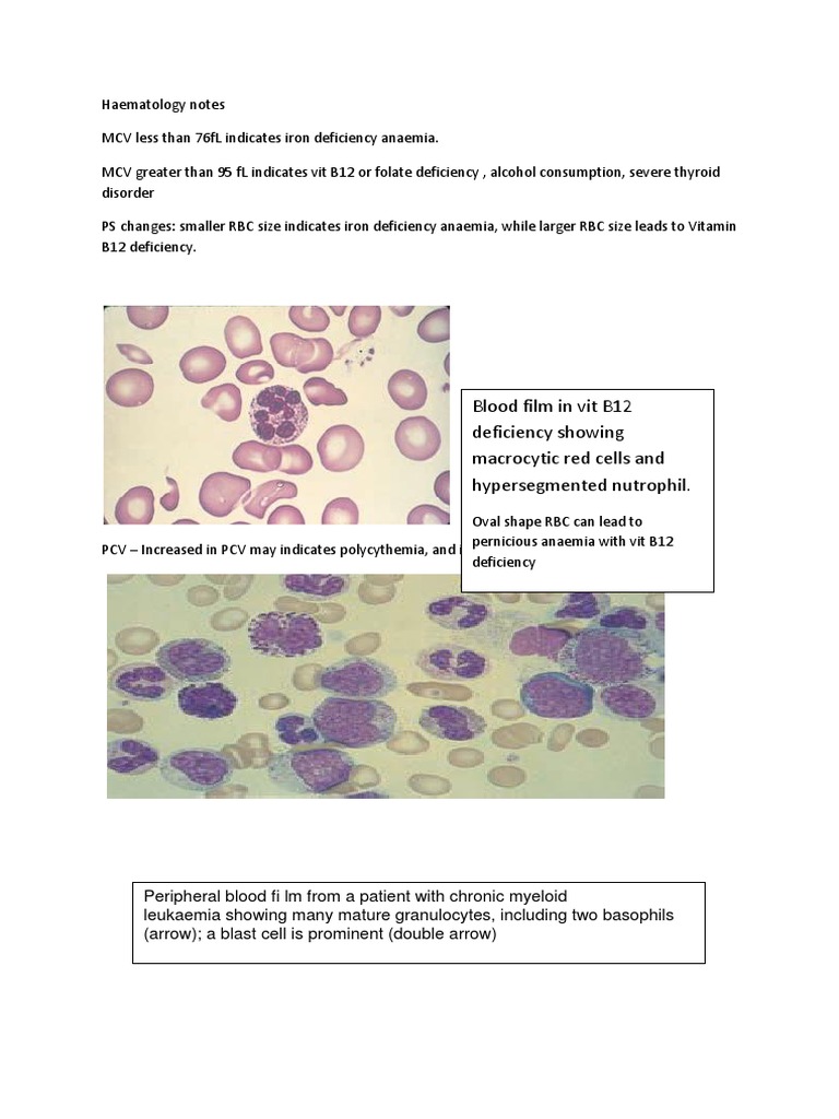 Haematology Notes on Anemia and Blood Disorders | PDF