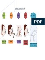 Maniobra supraglótica paso a paso