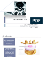 Hernia de disco lumbar: anatomía, fisiopatología, diagnóstico y tratamiento