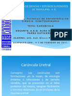 Carúncula Uretral