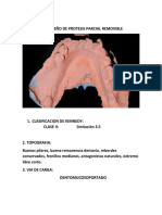 Diseño de Protesis Parcial Removible 2