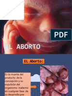 aborto