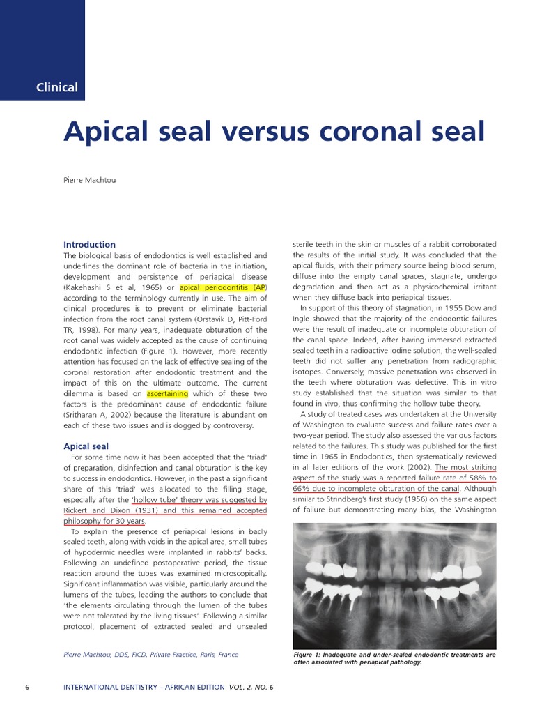 Apical Seal Versus Coronal Seal PDF Mouth Dentistry