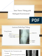 Tumor Tulang Pada Radiologi