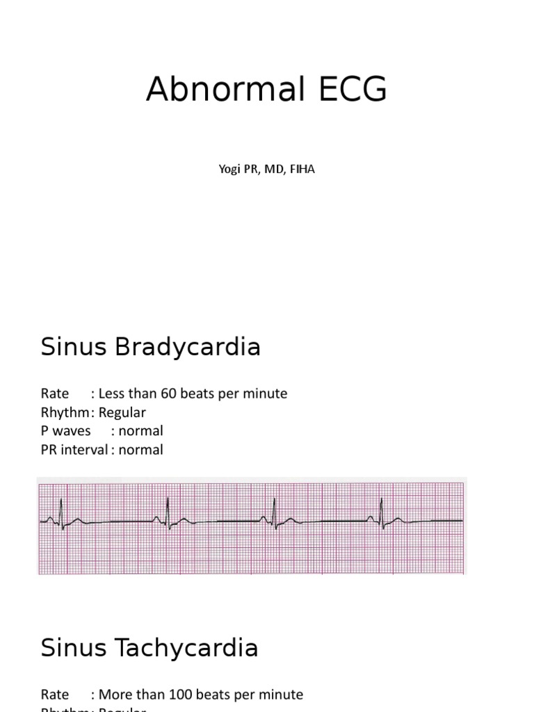 Abnormal ECG Patterns Overview | PDF | Circulatory System | Physiology