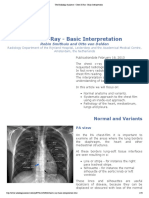 Tema 1 - The Radiology Assistant _ Chest X-Ray - Basic Interpretation
