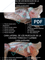 Cara Lateral de Los Musculos de La Cavidad Toraxica y Lumbar Vista Profunda