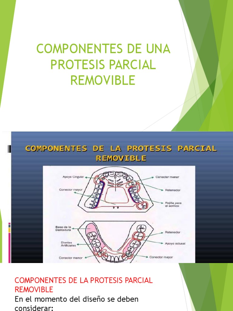 Componentes de la Prótesis Parcial Removible | PDF | Ciencia y ...