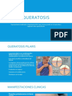 Queratosis Pilaris