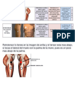 Ubicación Del Retrotensor de La Fascia Lata Imagen y Tipo de Patologia Que Pertenece