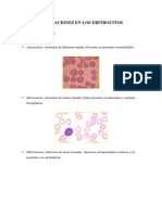 Alteraciones eritrocitarias: causas, síntomas y tratamiento de la anemia y leucemia