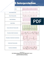 10 Common EKG Heart Rhythms PDF