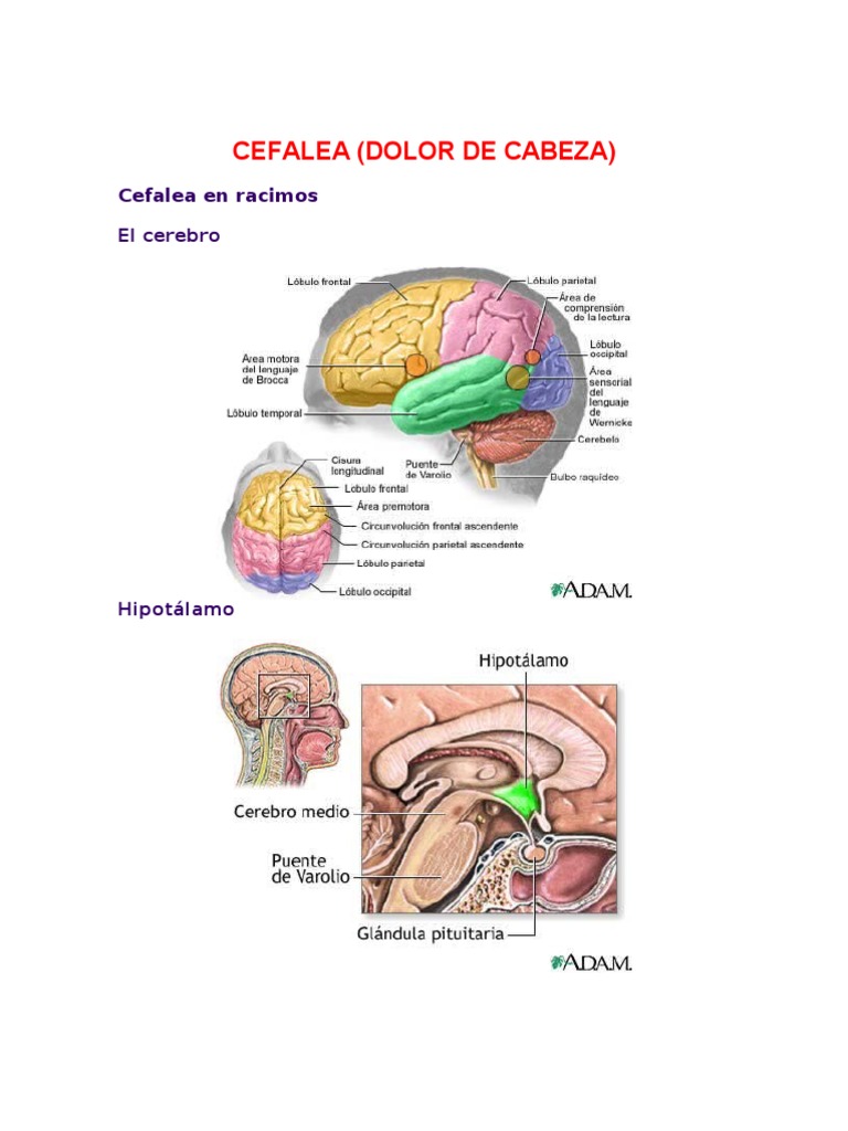 Cefalea en Racimos: Causas y Tratamiento | PDF | Migraña | Dolor de cabeza