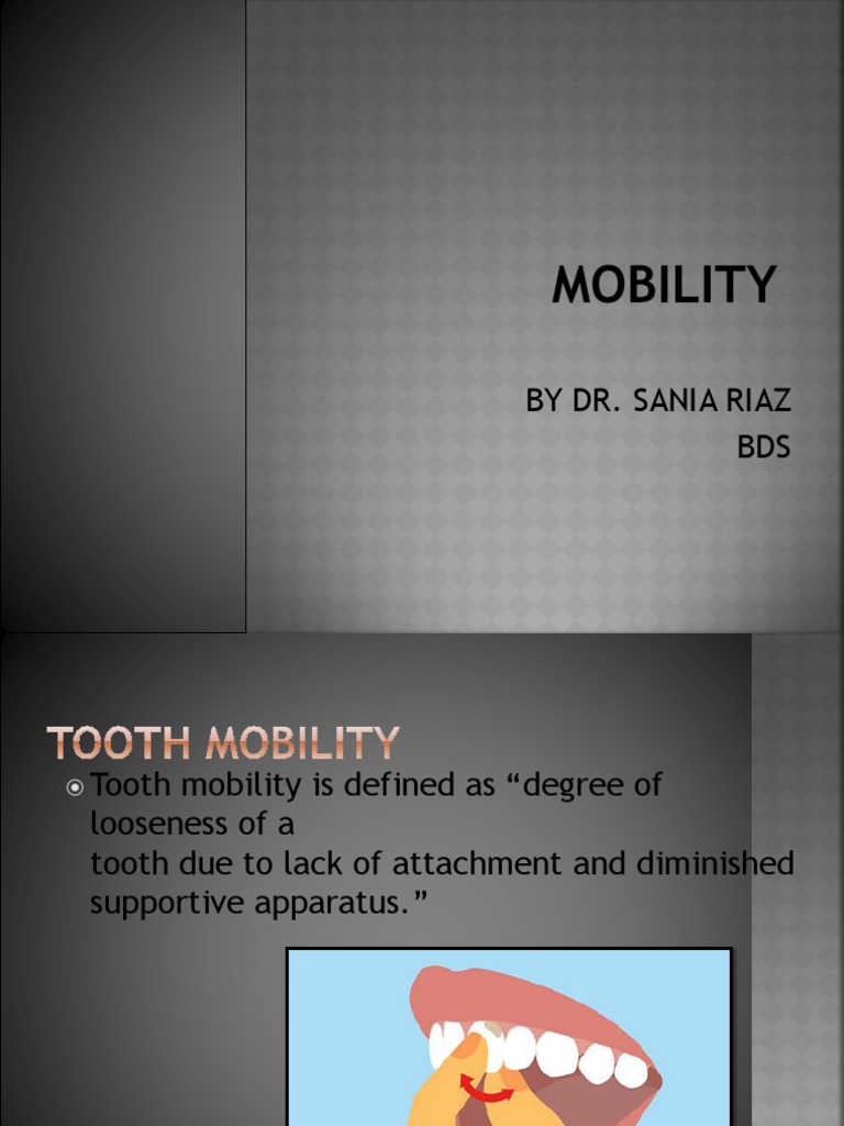 Tooth Mobility Classification Overview | PDF