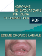 Anomalii Cranio Maxilo Faciale PDF