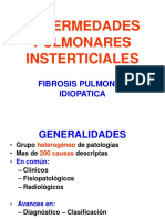 Enfermedades Insterticiales