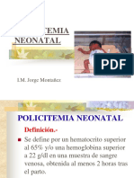 Policitemia Neonatal