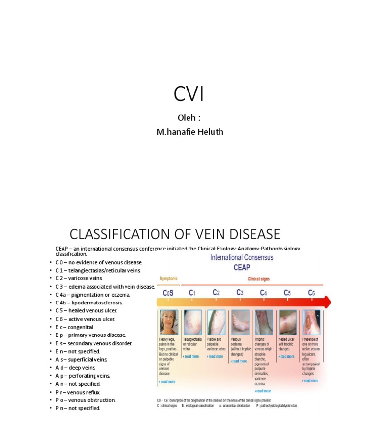 Vein Disease Classification Guide | PDF | Social Science | Art
