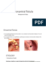 Oroantral Fistula