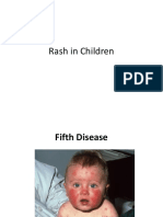 Rash in Children